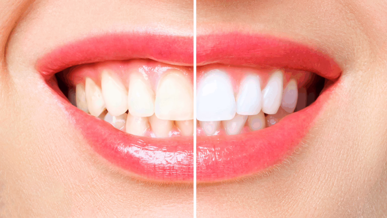 Cosmetic Dentistry Options to Help You Love Your Smile