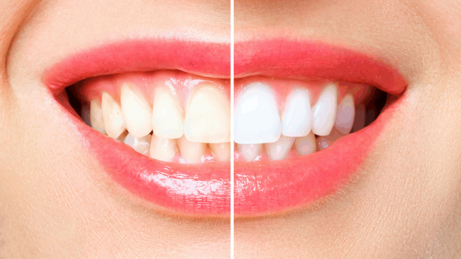 Cosmetic Dentistry Options to Help You Love Your Smile