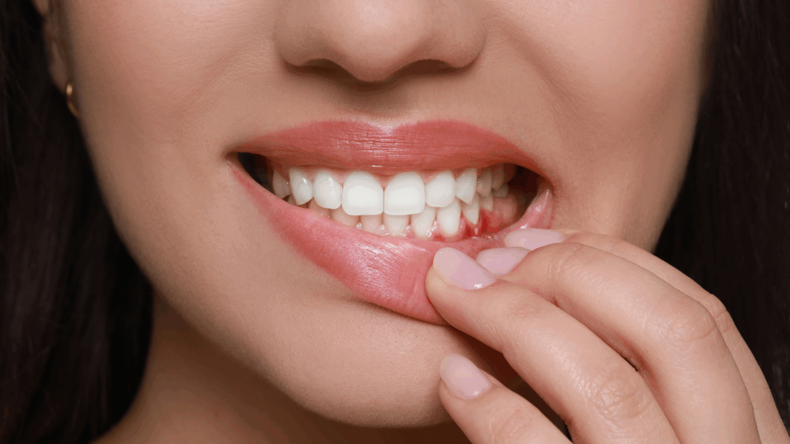 Preventing Gum Disease: Expert Tips from a Brentwood Dentist