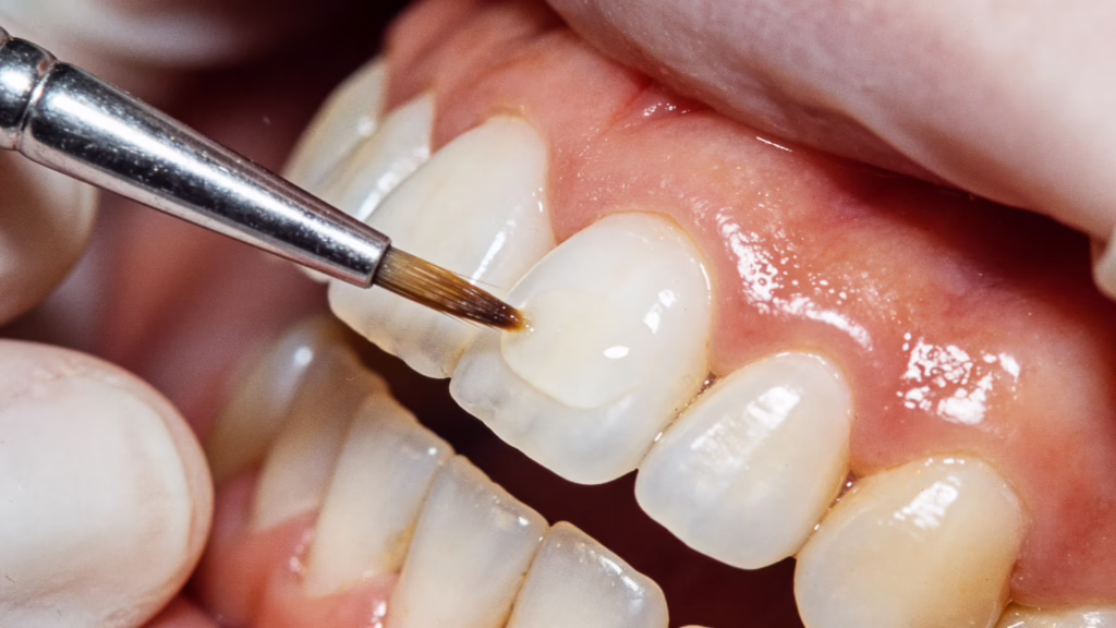 The Real Cost of Cosmetic Dentistry in Los Angeles