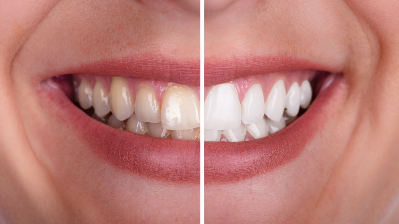 When Should You See a Dentist for Yellow Teeth?